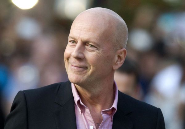 Male Pattern Baldness Hairstyles 1