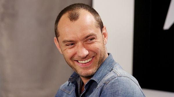 Male Pattern Baldness Hairstyles 2