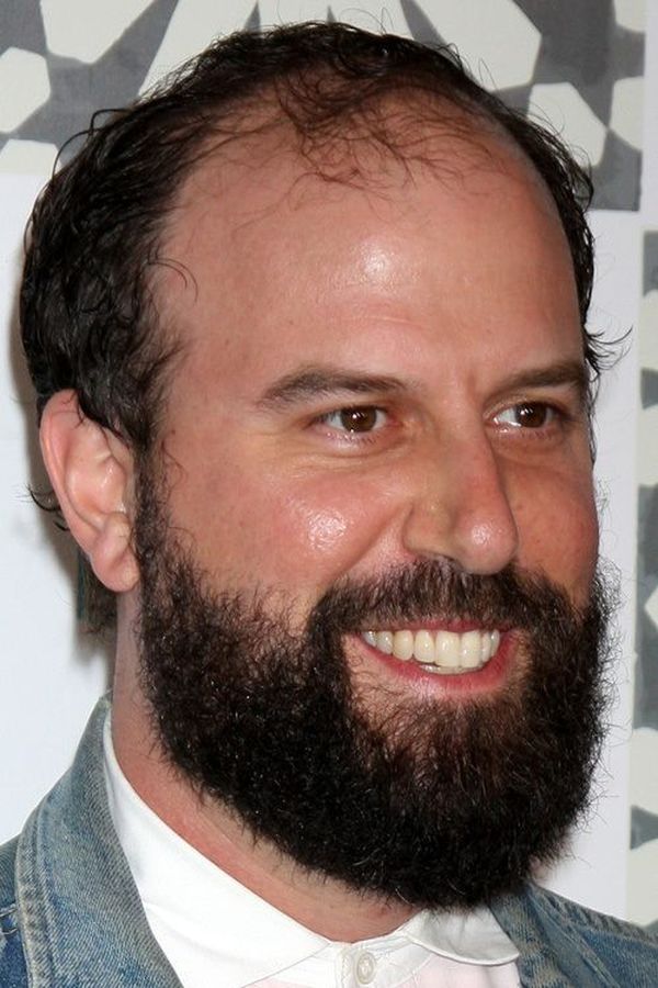 Male Pattern Baldness Hairstyles 3