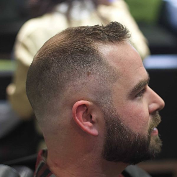 Pick a Haircut for Bald Spot on Crown of Head 3